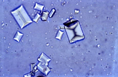 struvite-crystals-in-cats-2